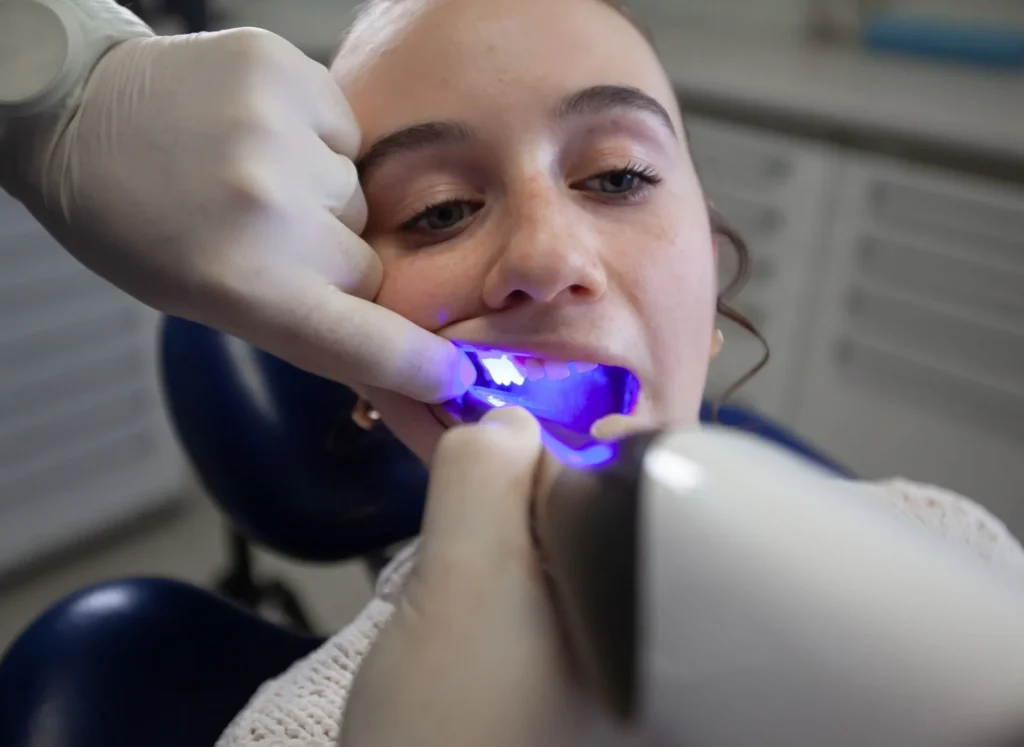 Quanto costa la pulizia dei denti dal dentista